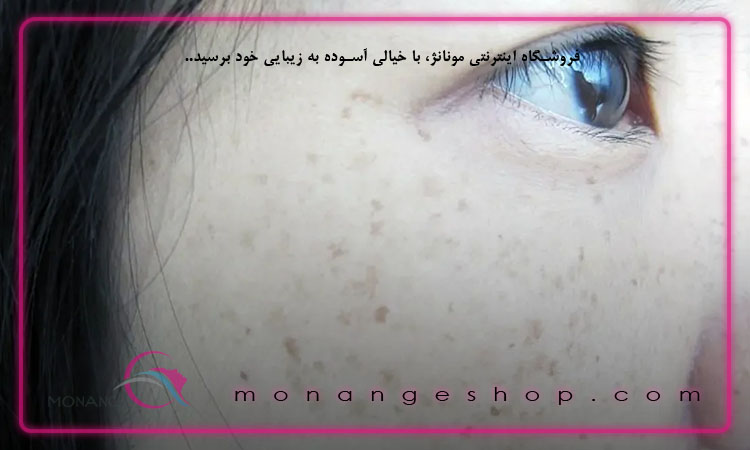 دلایل بروز لکه‌ های ناگهانی روی پوست