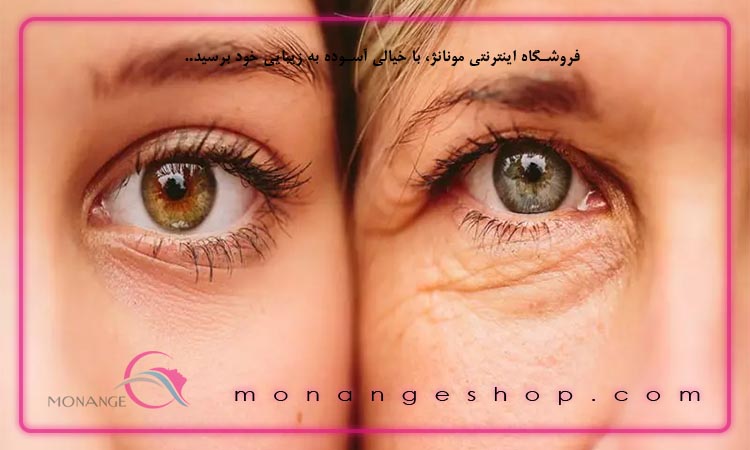 روش های رفع چروک دور چشم