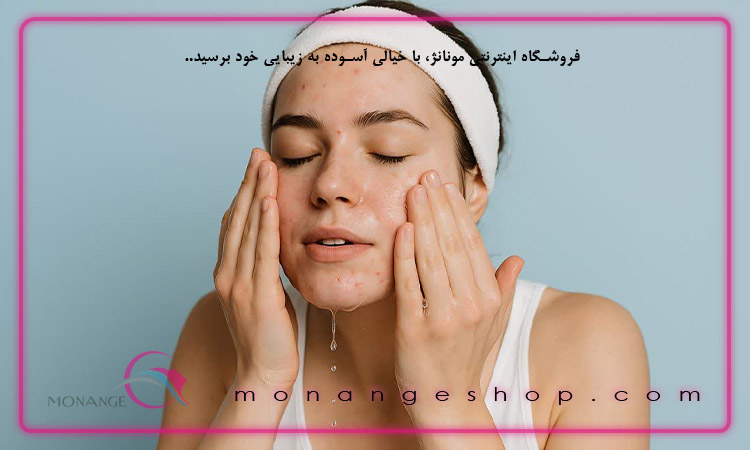 درمان جوش صورت