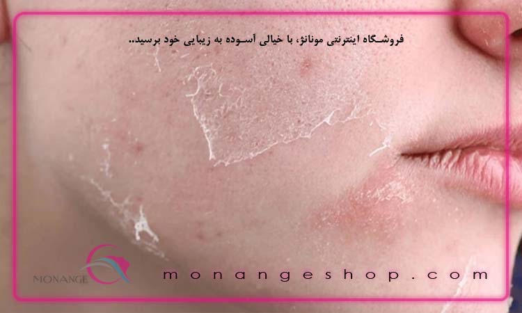 چرا پوست با استفاده از آبرسان هنوز خشک است؟