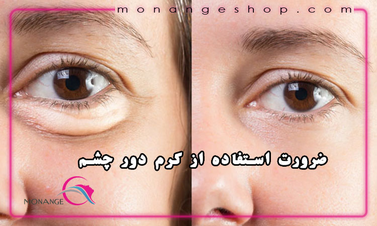 ضرورت استفاده از کرم دور چشم